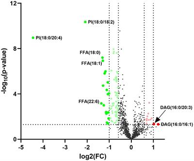 Integration Profiling Between Plasma Lipidomics, Epstein–Barr Virus and Clinical Phenomes in Nasopharyngeal Carcinoma Patients